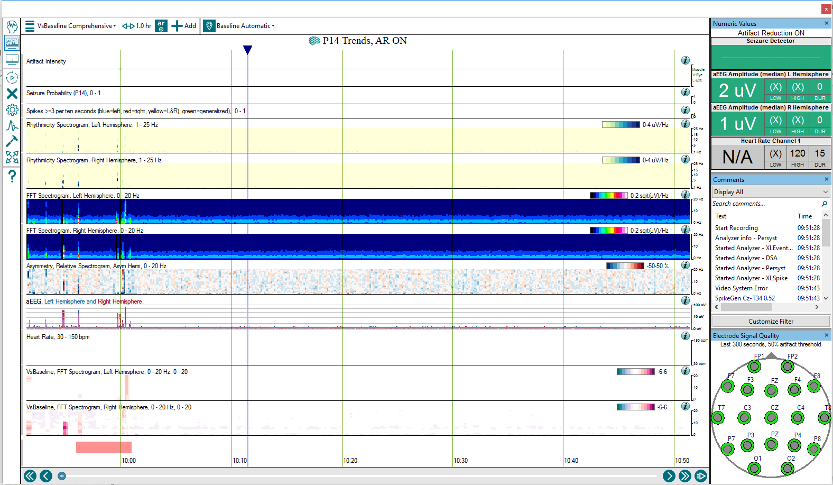 Configure Display